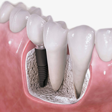 Clínica Le Blanc Odontología Integral