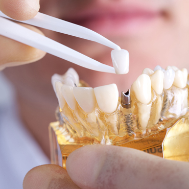 Clínica Le Blanc Odontología Integral